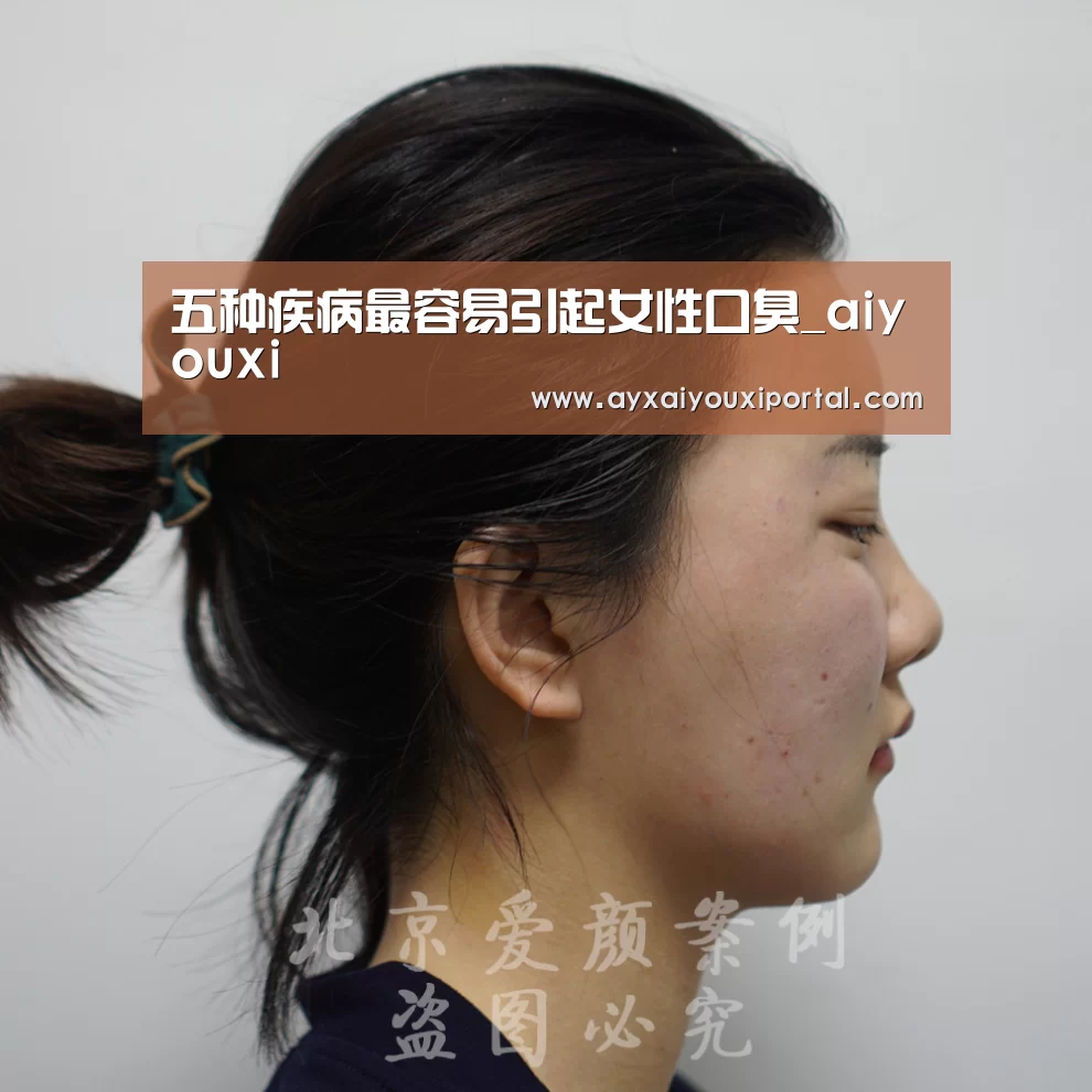 五种疾病最容易引起女性口臭_aiyouxi(图1) 五种疾病最容易引起女性口臭_aiyouxi(图1)